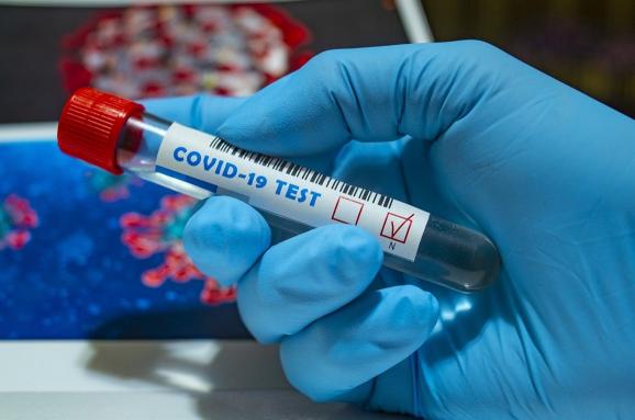 В Україні зменшилась кількість хворих на коронавірус 