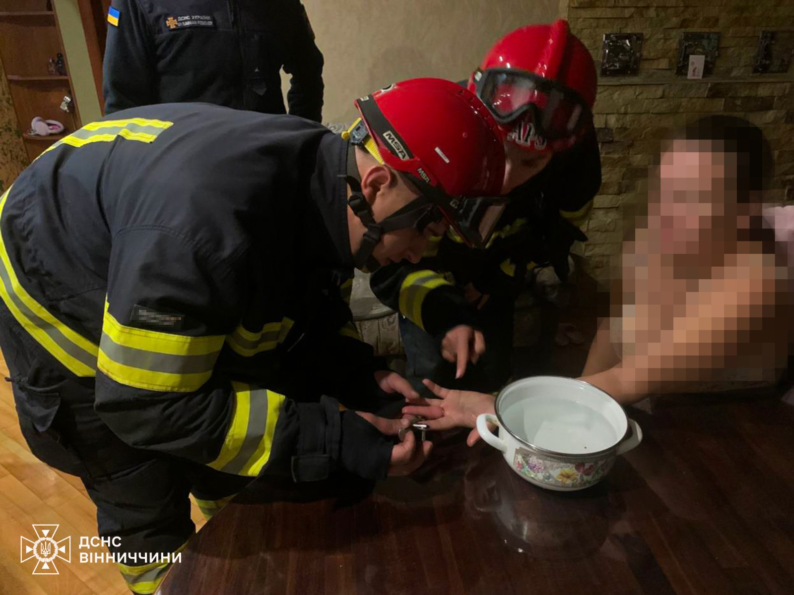 У Вінниці рятувальники допомогли жінці зняти обручку з пальця