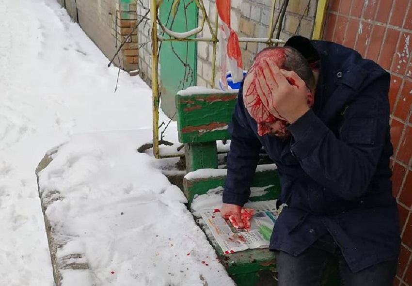 Криваве пограбування у центрі Києва: жертву побили прямо у пункту поліції