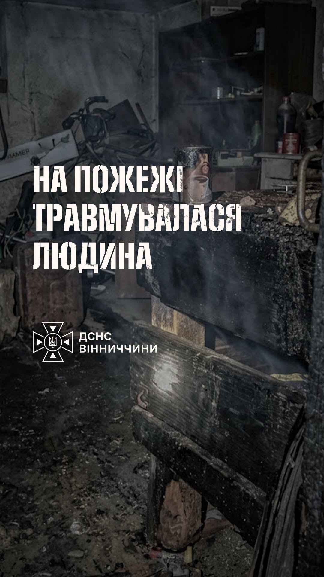 На Вінниччині чоловік отримав опіки, намагаючись самостійно загасити пожежу