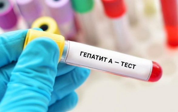 Збільшення випадків гепатиту А у Вінницькій області: 247 випадків 