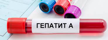 Кількість хворих на гепатит А зростає в Вінниці, 141 пацієнт в лікарні