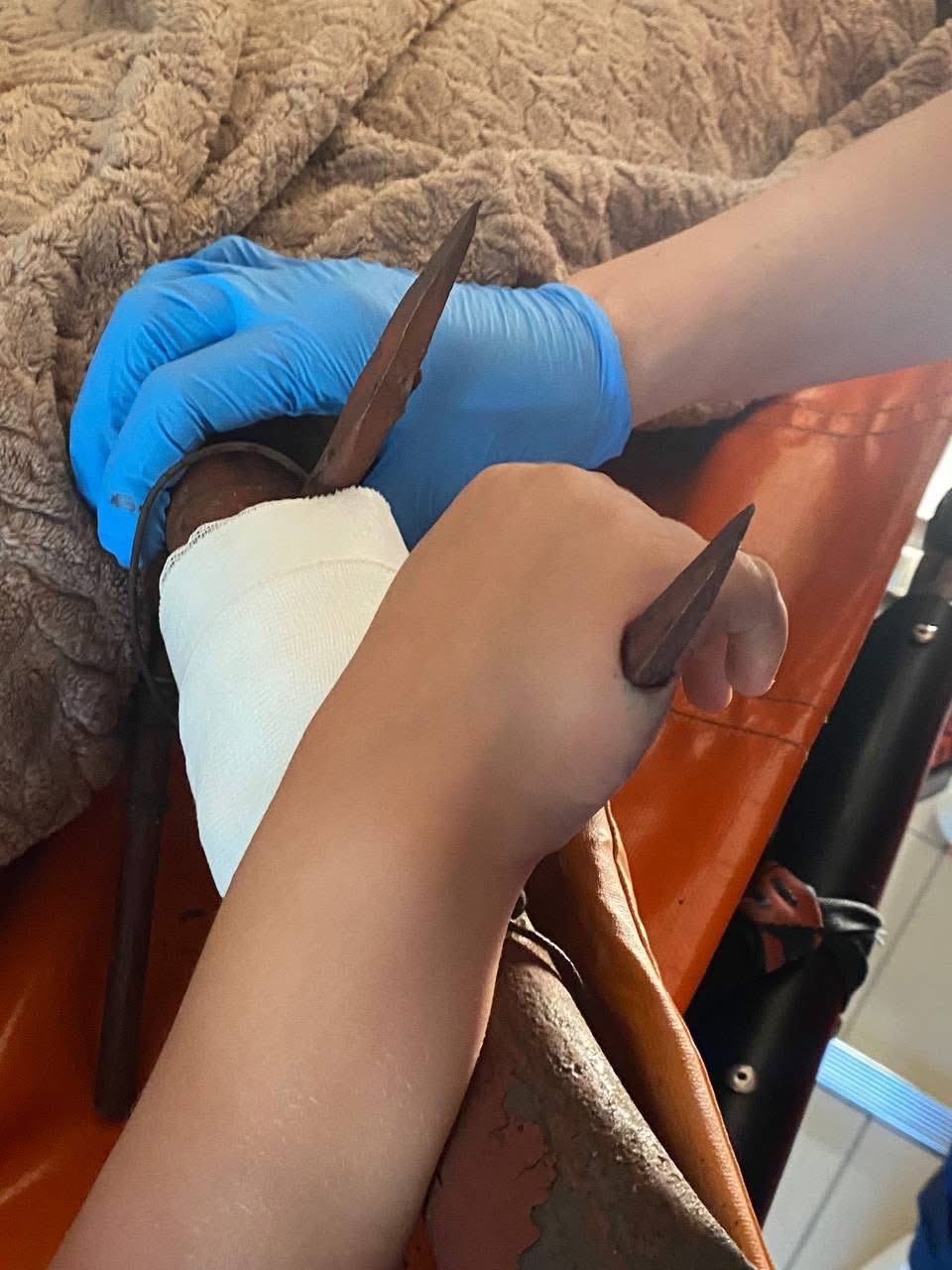 Юний герой з пораненою рукою: у Вінниці хлопчик постраждав, рятуючи кота з паркану