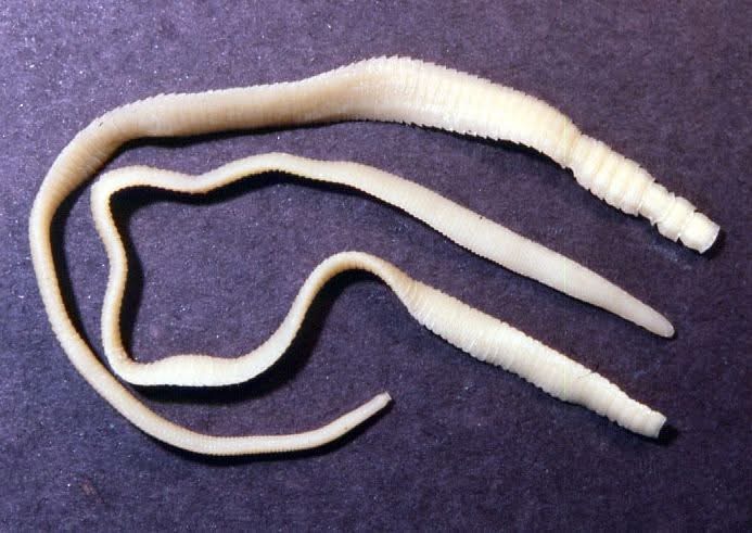 У Вінниці в однорічної дитини виявили карликового ціп’яка: лікарі закликають батьків бути уважними до гігієни