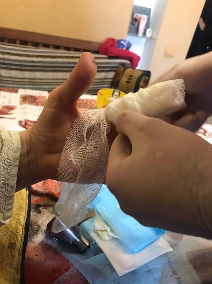 У Києві жінка засунула пальці до насадки ручного блендеру