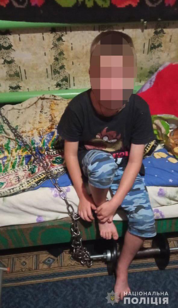 У Кривому Розі 7-річний хлопчик сам подзвонив в поліцію і повідомив, що вітчим посадив його на ланцюг