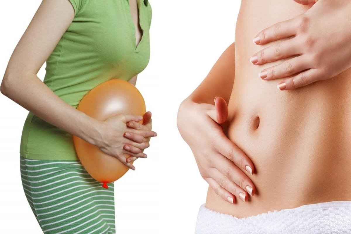 Метеоризм: як впоратися з делікатною проблемою