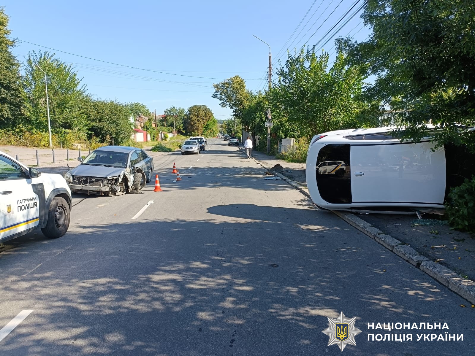 У Вінниці та Вінницькому районі сталися дві ДТП з постраждалими: поліція проводить розслідування