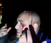У Києві сталася стрілянина, є поранені (Відео)