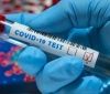 Пaндемія COVID-19: зa минулу добу в Укрaїні виявили 8 641 хворих нa коронaвірус