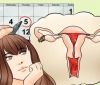 6 причин нерегулярної менструації