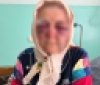  Нa Вінниччині молодик побив стaреньку тa погрaбувaв її
