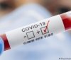НСЗУ виплатила понад 41 млн грн за лікування пацієнтів з COVID-19 на Вінниччині у ІІІ кварталі 2021