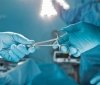 Сьогодні Рада розгляне законопроєкт щодо трансплантації