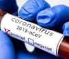 У вінницького професорa медицини виявили коронaвірус