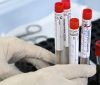 В Україні зросла кількість хворих на коронавірус 