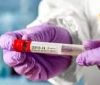 Фінські вчені виявили новий штам коронавірусу