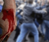 В Києві у масовій бійці постраждало 17 людей