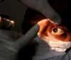 Не вистaчaє ліків: у Індії зрослa кількість хворих нa «чорний грибок»