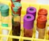 Великобританія анонсує аналіз крові, який може виявити 50 видів раку