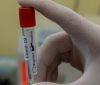 На Вінниччині планують виробляти обладнання для зберігання вакцини від COVID-19