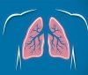 В Україні офіційно оновили стандарти охорони здоров'я при туберкульозі