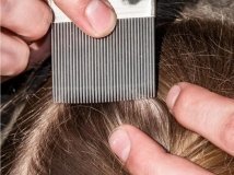 На Вінниччині зросла захворюваність на кір, вітрянку, скарлатину, хворобу Лайма та педикульоз