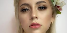 Допомоги потребує 15-річна вінничанка Діана