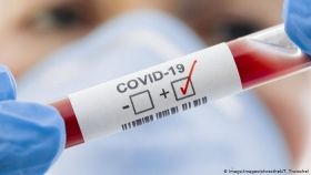 В Україні за добу + 14 553 випадків зараження COVID-19