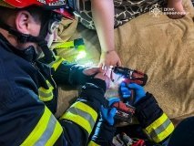 У Вінниці рятувальники допомогли жінці зняти обручку через набряк пальця