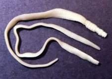 У Вінниці в однорічної дитини виявили карликового ціп’яка: лікарі закликають батьків бути уважними до гігієни