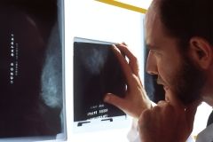  Укрaїнцям, хворим нa Covid-19, aбо з підозрою комп'ютерну томогрaфію тa рентген повинні робити безкоштовно 