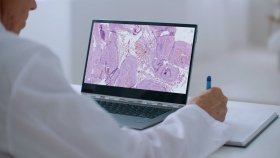 Штучний інтелект допомагатиме у діагностиці раку в Україні